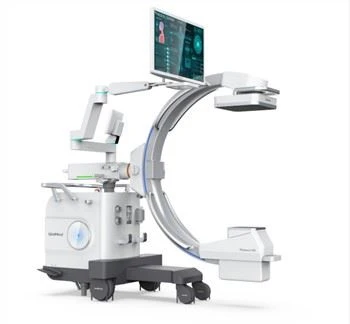 Máy X Ray C Arm Nhỏ Gọn Di Động Trong Phẫu Thuật